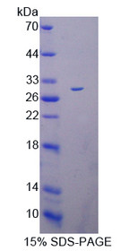 Figure 1. SDS-PAGE