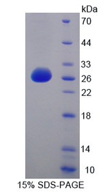 Figure 1. SDS-PAGE