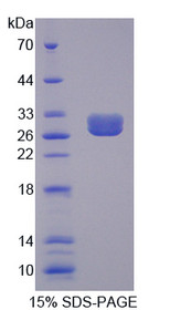 Figure 1. SDS-PAGE