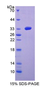 Figure 1. SDS-PAGE