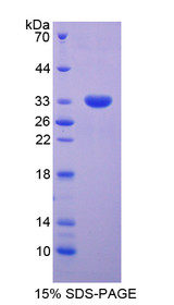 Figure 1. SDS-PAGE