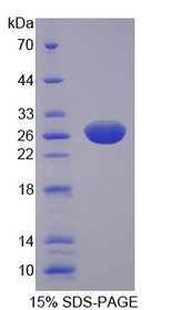 Figure 1. SDS-PAGE