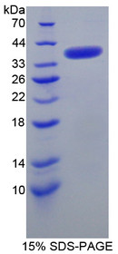 Figure 1. SDS-PAGE