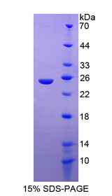Figure 1. SDS-PAGE