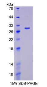 Figure 1. SDS-PAGE