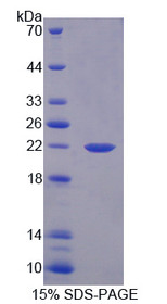 Figure 1. SDS-PAGE