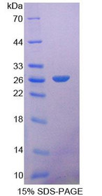 Figure 1. SDS-PAGE