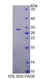 Figure 1. SDS-PAGE