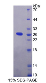Figure 1. SDS-PAGE
