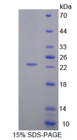 Figure 1. SDS-PAGE