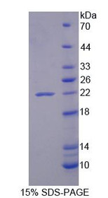Figure 1. SDS-PAGE