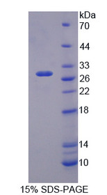 Figure 1. SDS-PAGE