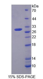 Figure 1. SDS-PAGE
