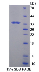 Figure 1. SDS-PAGE