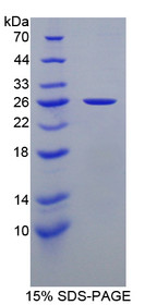 Figure 1. SDS-PAGE