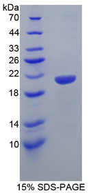 Figure 1. SDS-PAGE