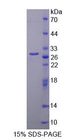 Figure 1. SDS-PAGE