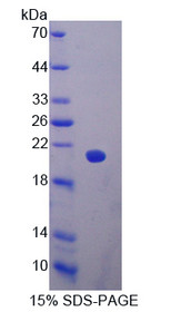 Figure 1. SDS-PAGE