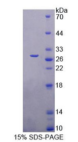 Figure 1. SDS-PAGE