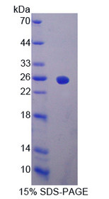 Figure 1. SDS-PAGE