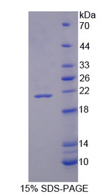 Figure 1. SDS-PAGE