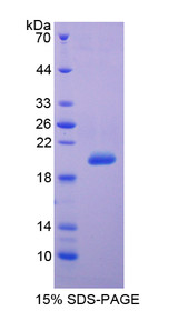 Figure 1. SDS-PAGE