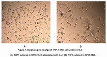 As reported, IL-4 will induce the differentiation of THP-1 cells into dendritic cells and macrophages in vitro. THP-1 cells were cultured in RPMI-1640 and stimulated with 2ng/mL IL-4, after 10 days of stimulation, partial cells became larger, grew synapses, and had vesicular bodies intracellular, which showed a morphological characteristics of dendritic cells and macrophages.