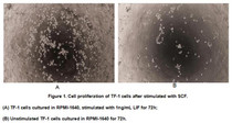 Leukemia inhibitory factor (LIF) is an interleukin 6 class cytokine that affects cell growth by inhibiting differentiation. When LIF levels drop, the cells differentiate. LIF derives its name from its ability to induce the terminal differentiation of myeloid leukemic cells, thus preventing their continued growth. Other properties attributed to the cytokine include: the growth promotion and cell differentiation of different types of target cells, influence on bone metabolism, cachexia, neural development, embryogenesis and inflammation. LIF has been shown to stimulate the proliferation of TF-1 cells. To test this effect, TF-1 cells were seeded into triplicate wells of 96-well plates at a density of 1x104 cells/well and incubated for 72h in the presence or absence of various concentrations of LIF at 37°C. The growth of cells were observed by inverted microscope and cell proliferation was measured by Cell Counting Kit-8 (CCK-8). Briefly, 10µL of CCK-8 solution was added to each well of the plate, then measure the absorbance at 450nm using a microplate reader after incubating the plate for 1-4 hours at 37 °C. Cell proliferation of TF-1 cells after incubation with SCF for 72h observed by inverted microscope was shown in Figure 1.