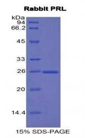 Figure 1. SDS-PAGE