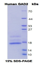 Figure 1. SDS-PAGE