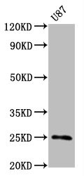 Western Blot; Positive WB detected in U87 whole cell lysate; All lanes CD9 antibody at 0.55µg/ml; Secondary; Goat polyclonal to rabbit IgG at 1/50000 dilution; Predicted band size: 25 KDa; Observed band size: 25 KDa;