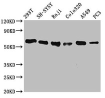 Western Blot; Positive WB detected in: 293T whole cell lysate, SH-SY5Y whole cell lysate, Raji whole cell lysate, Colo320 whole cell lysate, A549 whole cell lysate, PC3 whole cell lysate; All lanes: FTO antibody at 0.7µg/ml; Secondary; Goat polyclonal to rabbit IgG at 1/50000 dilution; Predicted band size: 59, 15, 7, 13 KDa; Observed band size: 59 KDa;