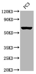 Western Blot; Positive WB detected in:PC3 whole cell lysate; All lanes: Muscarinic Acetylcholine Receptor M3 antibody at 1:2000; Secondary; Goat polyclonal to rabbit IgG at 1/50000 dilution; Predicted band size: 67 kDa; Observed band size: 67 kDa;
