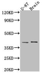 Western Blot; Positive WB detected in: U-87 whole cell lysate, Rat Brain whole cell lysate; All lanes: NGF antibody at 1:1000; Secondary; Goat polyclonal to rabbit IgG at 1/50000 dilution; Predicted band size: 27 kDa; Observed band size: 39 kDa;
