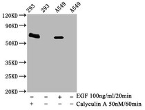 Western Blot; Positive WB detected in 293 whole cell lysate 549 whole cell lysate(treated with Calyculin A or EGF); All lanes Phospho-PRKAA2 antibody at 1.95µg/ml; Secondary; Goat polyclonal to rabbit IgG at 1/50000 dilution; Predicted band size: 62 KDa; Observed band size: 62 KDa;