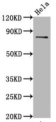 Western Blot; Positive WB detected in Hela whole cell lysate; All lanes Phospho-MAPT antibody at 0.67µg/ml; Secondary; Goat polyclonal to rabbit IgG at 1/50000 dilution; Predicted band size: 80 KDa; Observed band size: 80 KDa;