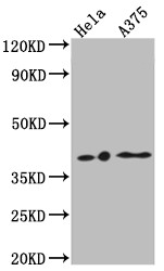 Western Blot; Positive WB detected in: Hela whole cell lysate, A375 whole cell lysate; All lanes: EDG2 antibody at 1:1000; Secondary; Goat polyclonal to rabbit IgG at 1/50000 dilution; Predicted band size: 42, 42 kDa; Observed band size: 42 kDa;