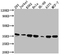 Western Blot; Positive WB detected in: 293 whole cell lysate, Jurkat whole cell lysate, K562 whole cell lysate, Hela whole cell lysate, HL-60 whole cell lysate, A375 whole cell lysate, MCF-7 whole cell lysate; All lanes: Syntaxin 4 antibody at 1:1000; Secondary; Goat polyclonal to rabbit IgG at 1/50000 dilution; Predicted band size: 35, 34 kDa; Observed band size: 35 kDa;