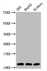 Western Blot; Positive WB detected in:293 whole cell lysate, HepG2 whole cell lysate, Mouse kidney tissue; All lanes:Acetyl-Histone H4 (K16) antibody at 1.65µg/ml; Secondary; Goat polyclonal to rabbit IgG at 1/50000 dilution; Predicted band size: 11 KDa; Observed band size: 11 KDa;