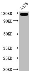 Western Blot; Positive WB detected in A375 whole cell lysate; All lanes CD146 antibody at 0.6ug/ml; Secondary; Goat polyclonal to rabbit IgG at 1/50000 dilution; Predicted band size: 72 KDa; Observed band size: 120 Kda