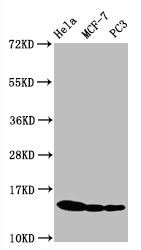 Western Blot; Positive WB detected in Hela whole cell lysate CF-7 whole cell lysate C3 whole cell lysate; All lanes Phospho-Histone H3.1(S10)antibody at 0.5ug/ml; Secondary; Goat polyclonal to rabbit IgG at 1/50000 dilution; Predicted band size: 15 KDa; Observed band size: 15 KDa