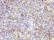 IHC image of RAC07083 diluted at 1:100 and staining in paraffin-embedded human lymph node tissue performed on a Leica BondTM system. After dewaxing and hydration, antigen retrieval was mediated by high pressure in a citrate buffer (pH 6.0). Section was blocked with 10% normal goat serum 30min at RT. Then primary antibody (1% BSA) was incubated at 4? overnight. The primary is detected by a biotinylated secondary antibody and visualized using an HRP conjugated SP system.