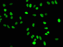 Immunofluorescence staining of Hela cells with RAC07087 at 1:50,counter-stained with DAPI. The cells were fixed in 4% formaldehyde, permeabilized using 0.2% Triton X-100 and blocked in 10% normal Goat Serum. The cells were then incubated with the antibody overnight at 4?.The secondary antibody was Alexa Fluor 488-congugated AffiniPure Goat Anti-Rabbit IgG (H+L).