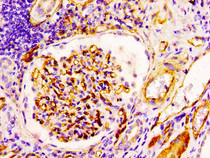 IHC image of RAC07097 diluted at 1:100 and staining in paraffin-embedded human kidney tissue performed on a Leica BondTM system. After dewaxing and hydration, antigen retrieval was mediated by high pressure in a citrate buffer (pH 6.0). Section was blocked with 10% normal goat serum 30min at RT. Then primary antibody (1% BSA) was incubated at 4? overnight. The primary is detected by a biotinylated secondary antibody and visualized using an HRP conjugated SP system.