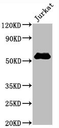 Western Blot; Positive WB detected in Jurkat whole cell lysate; All lanes CD4 antibody at 0.8ug/ml; Secondary; Goat polyclonal to rabbit IgG at 1/50000 dilution; Predicted band size: 55 KDa; Observed band size: 55 Kda