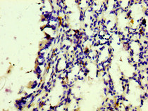 IHC image of RAC07109 diluted at 1:100 and staining in paraffin-embedded human lung tissue performed on a Leica BondTM system. After dewaxing and hydration, antigen retrieval was mediated by high pressure in a citrate buffer (pH 6.0). Section was blocked with 10% normal goat serum 30min at RT. Then primary antibody (1% BSA) was incubated at 4? overnight. The primary is detected by a biotinylated secondary antibody and visualized using an HRP conjugated SP system.