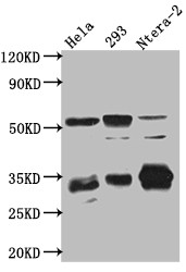 Western Blot; Positive WB detected in: Hela whole cell lysate, HEK293 whole cell lysate, Ntera-2 cell lysate; All lanes: CASP3 antibody at 1:1000; Secondary; Goat polyclonal to rabbit IgG at 1/50000 dilution; Predicted band size: 32 kDa; Observed band size: 32, 55, 130 kDa