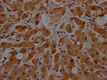 IHC image of RAC07151 diluted at 1:100 and staining in paraffin-embedded human liver tissue performed on a Leica BondTM system. After dewaxing and hydration, antigen retrieval was mediated by high pressure in a citrate buffer (pH 6.0). Section was blocked with 10% normal goat serum 30min at RT. Then primary antibody (1% BSA) was incubated at 4? overnight. The primary is detected by a Goat anti-rabbit IgG polymer labeled by HRP and visualized using 0.05% DAB.