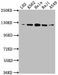 Western Blot; Positive WB detected in: L02 whole cell lysate, K562 whole cell lysate, Hela whole cell lysate, Raji whole cell lysate, A549 whole cell lysate; All lanes: ACLY antibody at 1:1500; Secondary; Goat polyclonal to rabbit IgG at 1/50000 dilution; Predicted band size: 121, 120, 92 kDa; Observed band size: 120 kDa