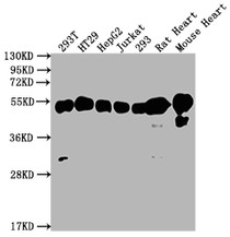 Western Blot; Positive WB detected in: 293T whole cell lysate, HT29 whole cell lysate, HepG2 whole cell lysate, Jurkat whole cell lysate, 293 whole cell lysate, Rat Heart tissue, Mouse Heart tissue; All lanes: ATP5F1B antibody at 1:2000; Secondary; Goat polyclonal to rabbit IgG at 1/50000 dilution; Predicted band size: 57 kDa; Observed band size: 57 kDa